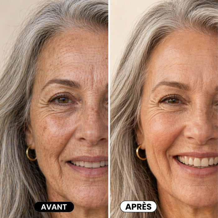 Dès application